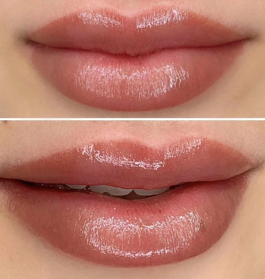 L19 ALMONDS (Hybrid) Bild 2